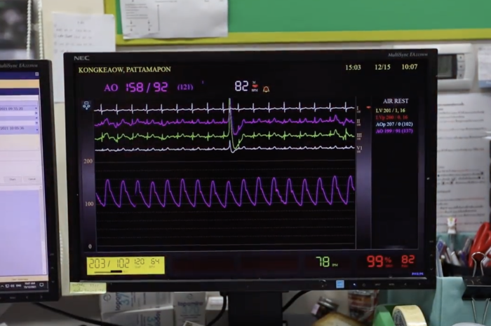Cardiovascular disease is the disease with the highest mortality rate in the top 5 of Thai people.